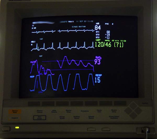 Vital Signs